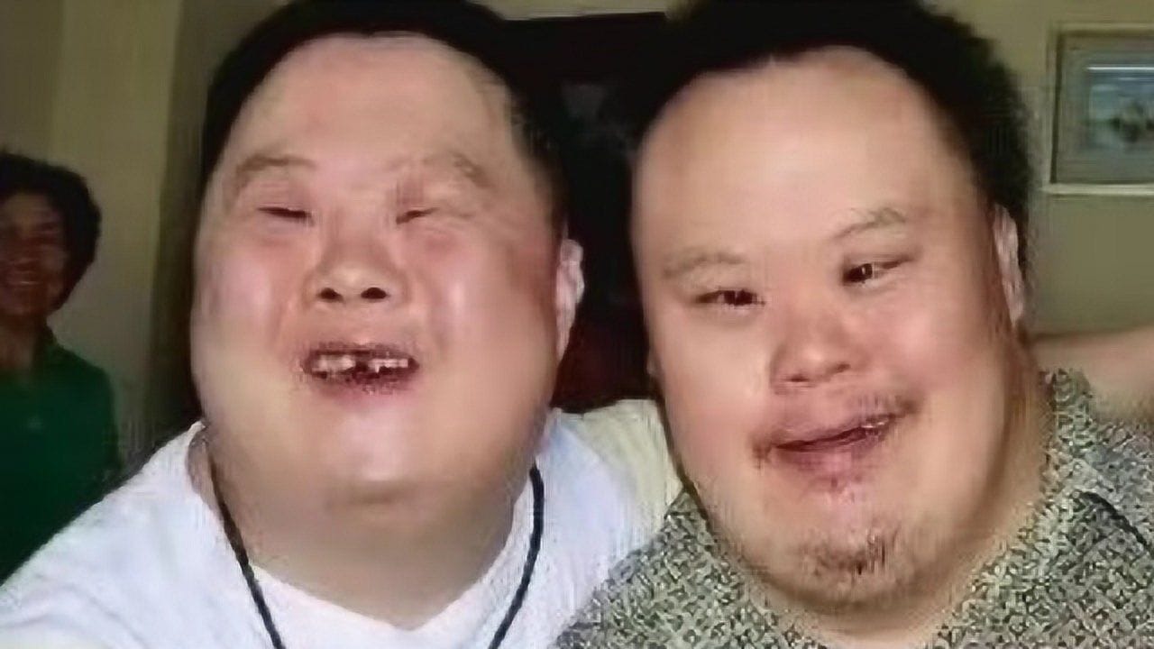 唐氏筛查